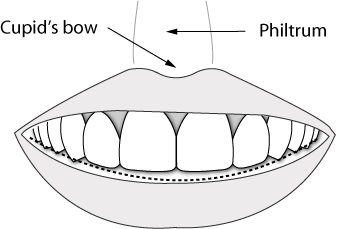 Reverse Smile Line